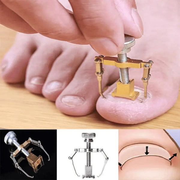 Nageltrång