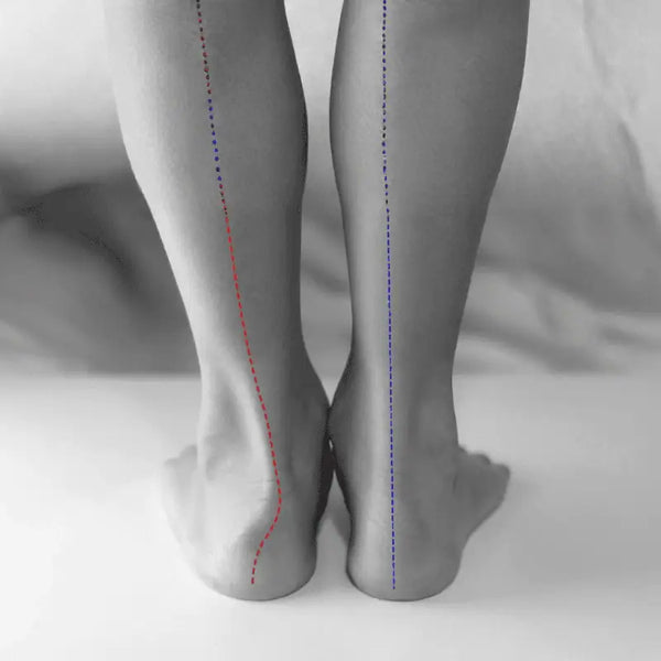 Pronation