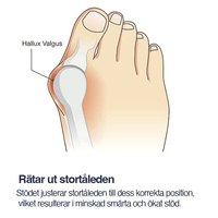 Korrigerande hallux valgus-stöd med tåseparerare (2-pack)